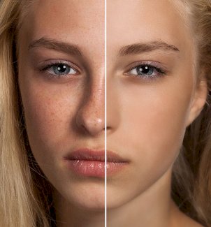 intensiv Sauerstoff Gesichtsbehandlung - Gratisinserat.ch